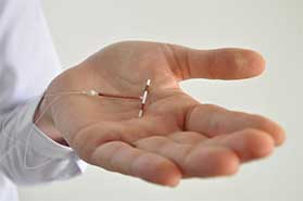 Intrauterine Devices (IUDs) Pearl, MS